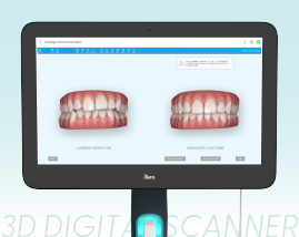 3D DIGITAL SCANNER