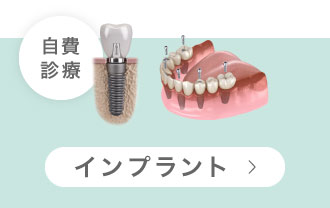 インプラント