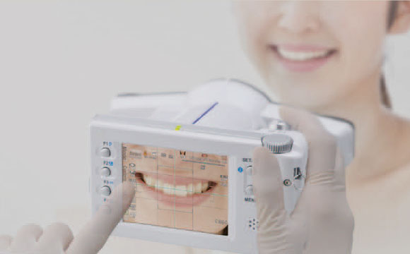 口腔内写真撮影