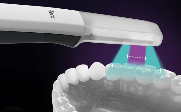 光学印象（iTero）