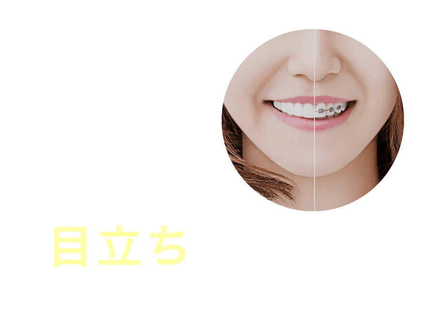 装置が透明で目立ちにくい