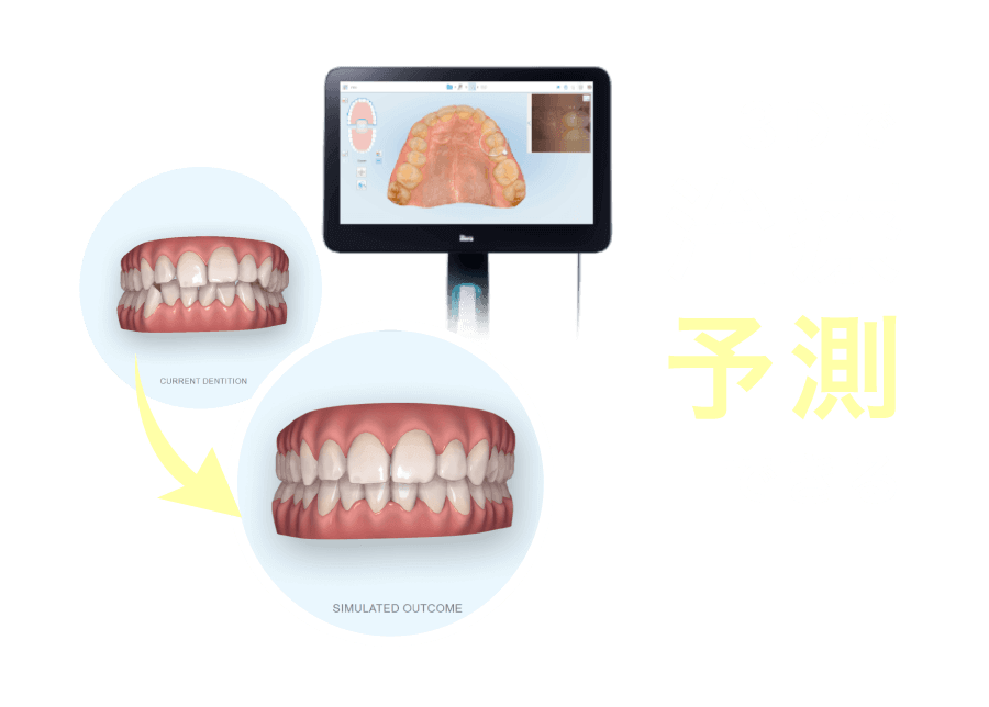 3Dで治療予測ができる