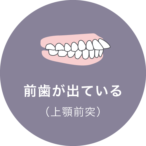 前歯が出ている（上顎前突）