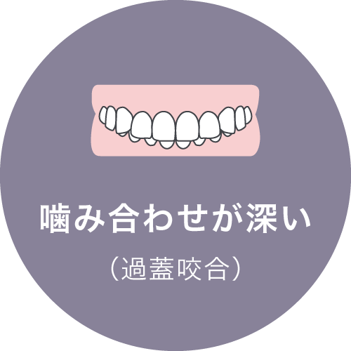 噛み合わせが深い（過蓋咬合）