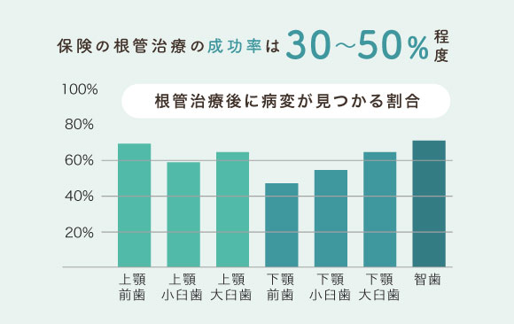 保険の根管治療の成功率は30〜50％程度